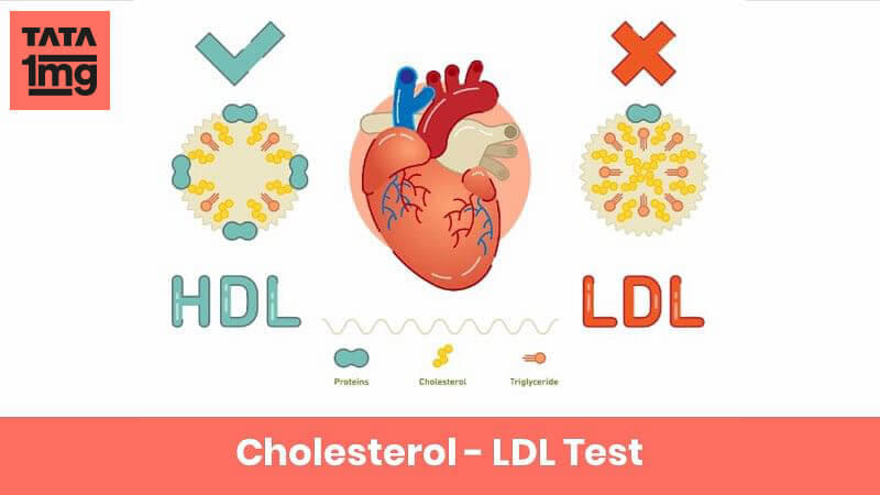 Cholesterol - LDL